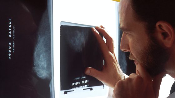 A doctor examines mammograms on a view box.